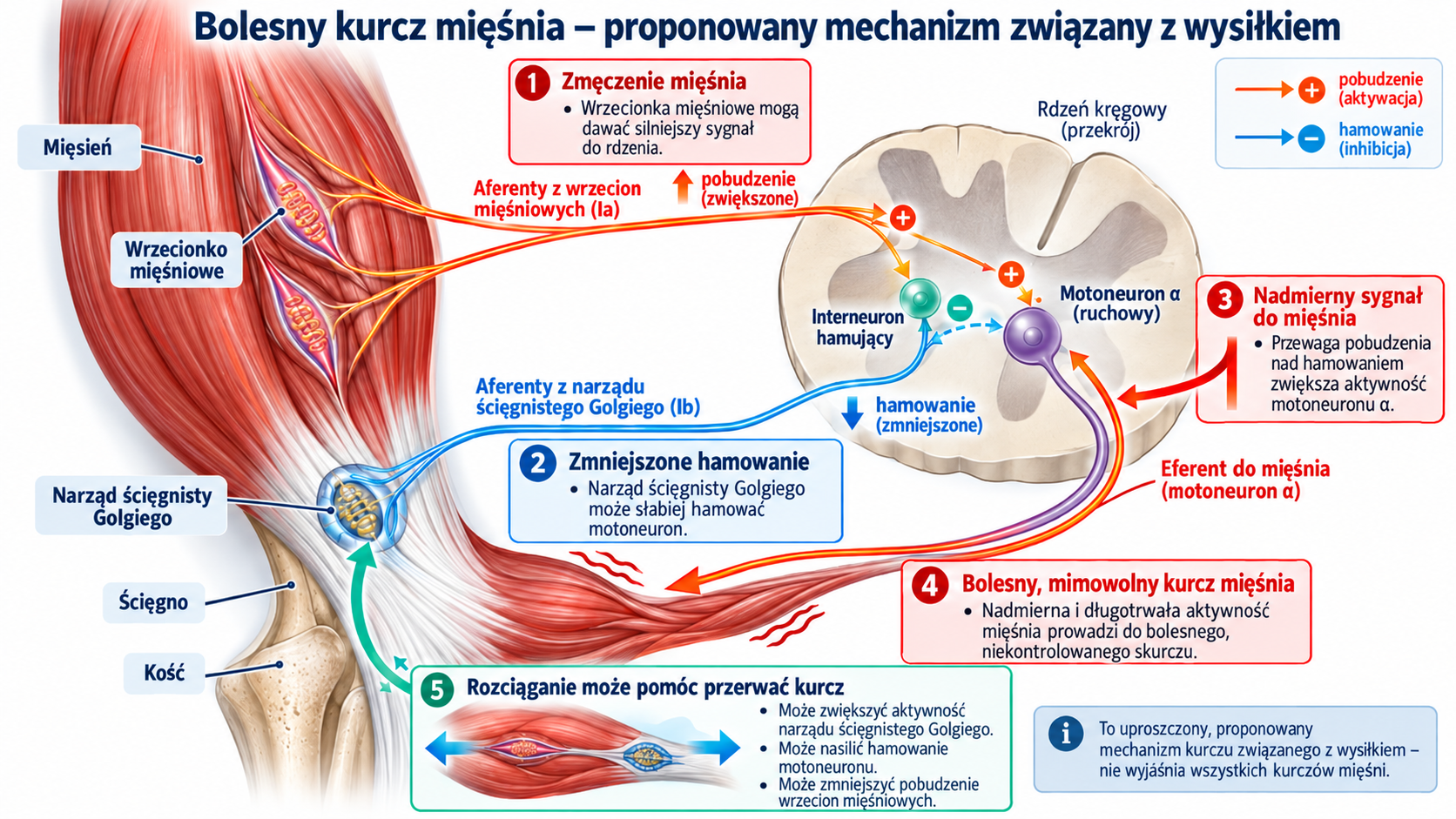 Schemat kontroli nerwowo-mięśniowej podczas bolesnego kurczu z udziałem wrzecionek mięśniowych i narządów ścięgnistych Golgiego